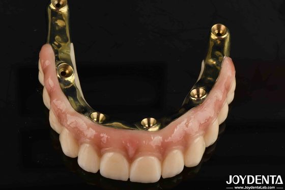 Prosthesis Gigi Ti-Bar Zirconia Hybrid Bridge Dengan Standar Biokompatibilitas Tinggi