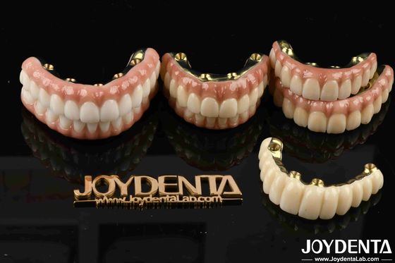 Zirconia untuk memulihkan fungsi mengunyah Fungsi optimal dijamin