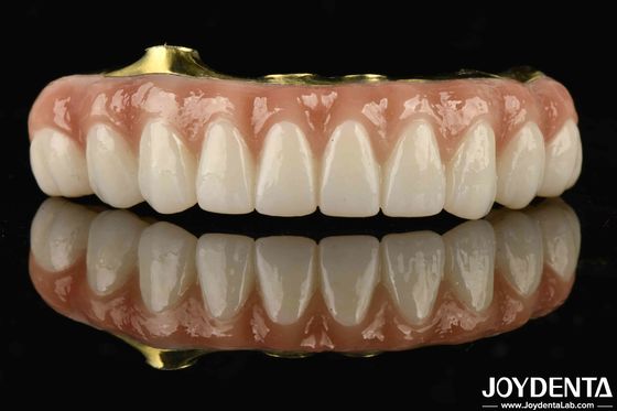 Titanium Dan Zirconia Nyaman Nyaman Untuk Memakai Ti-Bar Zirconia Hybrid Bridge Untuk Penggantian Gigi Yang Hilang