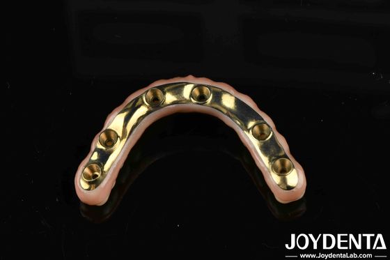 Jembatan Hibrida Zirconia Ti-Bar yang dibuat khusus untuk kenyamanan dan daya tahan dalam restorasi gigi