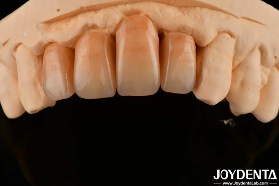 Zirconia berlapis yang dipoles putih dan tahan lama untuk permukaan yang sempurna