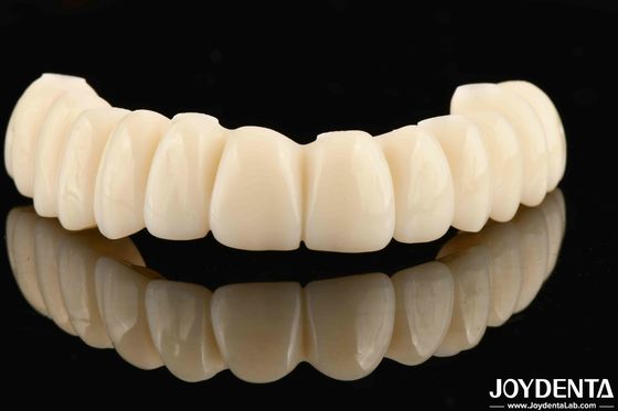 Jembatan Hibrida Zirconia Ti-Base yang dapat disesuaikan dengan daya tahan yang sangat baik dan biokompatibilitas yang baik