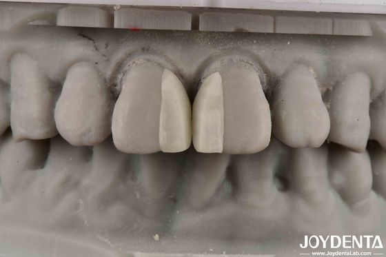 Permukaan melengkung tahan api Micro veneer Untuk dekorasi interior
