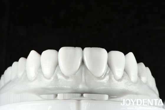 Natural Color Dental Wax Up Solusi serbaguna untuk restorasi satu atau beberapa gigi