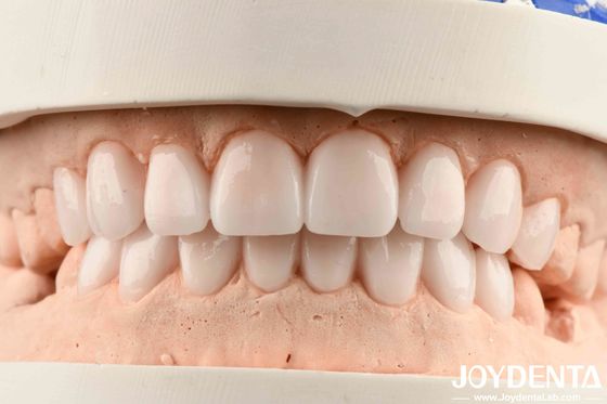 Berbagai bahan dan elastisitas yang baik dalam finishing gigi gigi fleksibel untuk logam dan resin