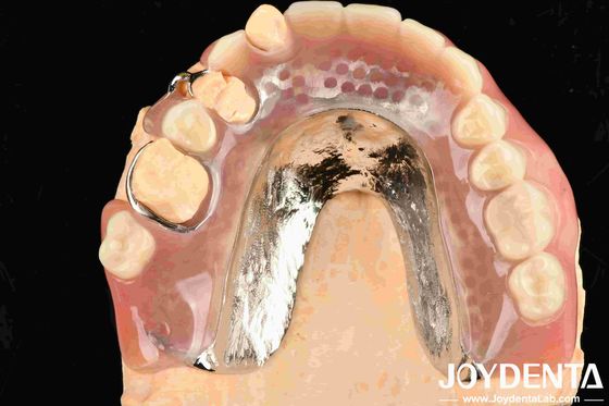 Kerangka Kerja Yang Cantik Dan Harmonious Set Up Teeth Finish Untuk Ruang Perawatan Gigi
