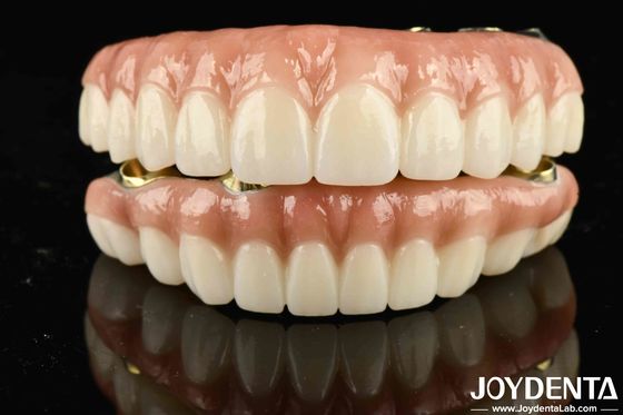High Durability Ti-Bar Zirconia Hybrid Bridge Untuk Mencapai Estetika
