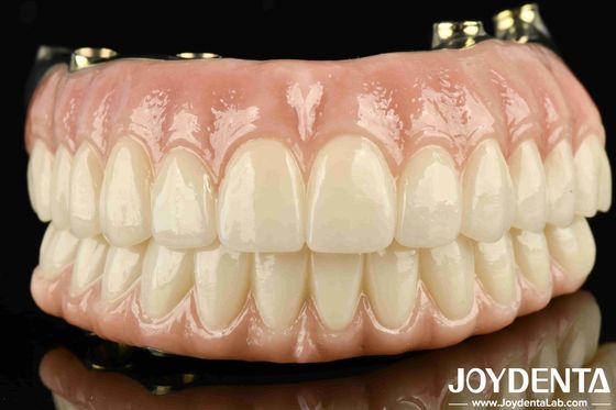 High Durability Ti-Bar Zirconia Hybrid Bridge Custom-made untuk Kepuasan Pribadi Dijamin