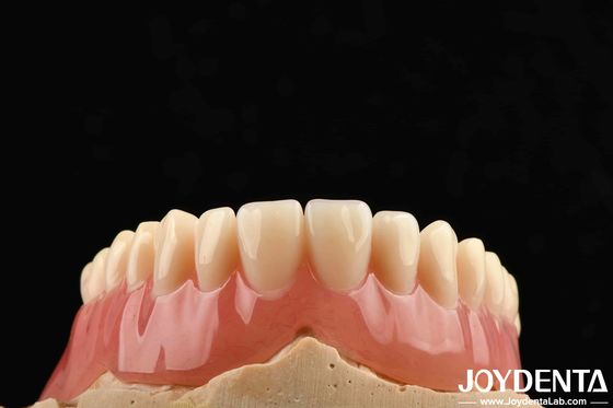Elastisitas Baik Akrilik Denture Finish Untuk Ringan Pribadi Disesuaikan dan Desain Disesuaikan
