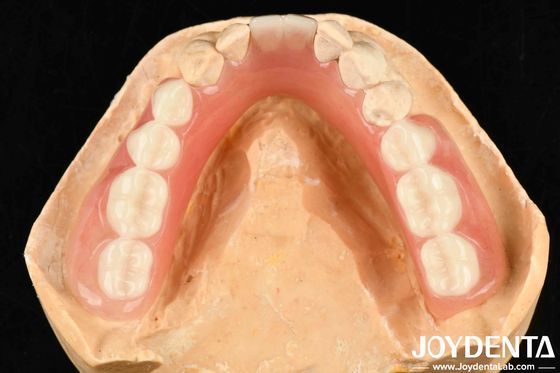 Berbagai Dan Ringan Bahan Resin Akrilik Denture Finish