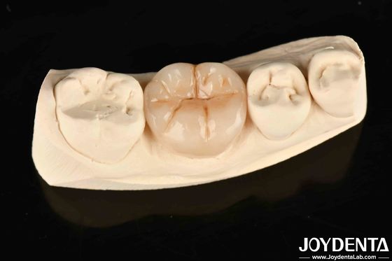 Full Zirconia High Wear Resistance dan Kekuatan Dalam Aplikasi Industri