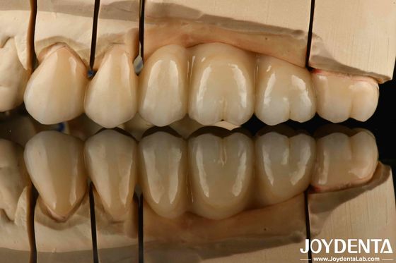 Zirconia Putih Penuh Dengan Ketahanan Tinggi Untuk Kejut Termal Kekuatan Tinggi