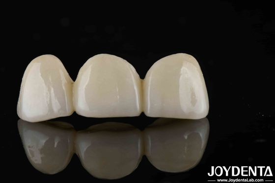 Gaya yang tampak alami dengan lapisan penuh Zirconia Translucence dan Estetika Tinggi