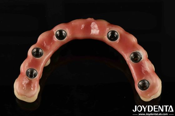 Jembatan Titanium Malong Hybrid yang disesuaikan Kombinasi sempurna dari teknik tradisional dan modern