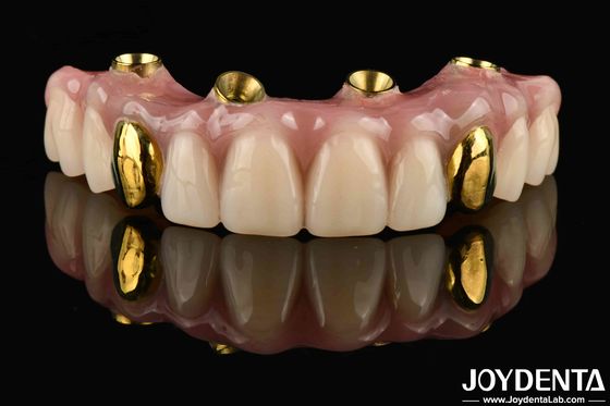Berbau Jelas Dan Ringan Ti-Bar Acrylic Teeth Finish Untuk Solusi Gigi