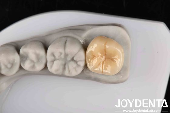 Ketahanan tinggi terhadap kejutan termal dan korosi Zirconia penuh dengan stabilitas kimia yang sangat baik