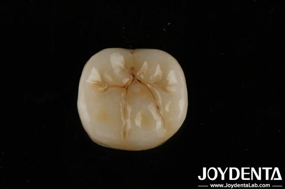 Tinggi Translucence Zirconia penuh dengan lapisan Biokompatibilitas dan kekuatan lentur 800 MPa
