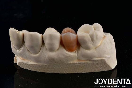 Biokompatibel dan terlihat alami Multilayer Full Zirconia Dengan Estetika