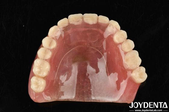 Bahan resin elastisitas yang baik meningkatkan kinerja dan daya tahan