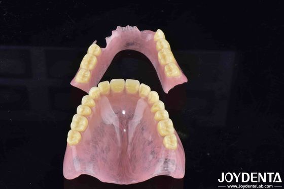 Teknologi Pengaturan Gigi Lanjutan Dental Akrilik Finish Dengan Elastisitas Baik Dan Fitur Beragam