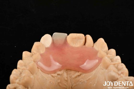 High Stealth Good Elasticity Fleksibel Denture Finish Untuk Berbagai Proses Manufaktur