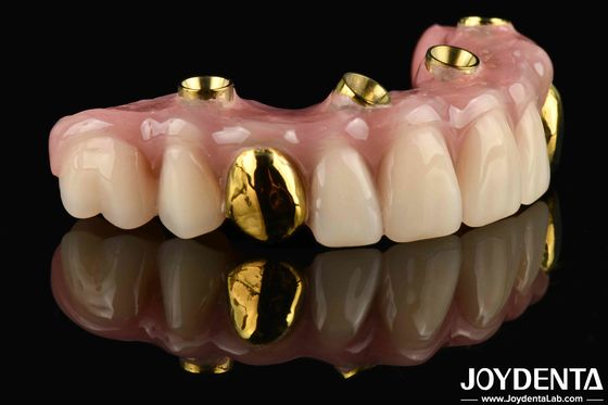 50ml Dentwre Dari Amerika Serikat Solusi Ultimate Anda Ti-Bar Acrylic Teeth Finish Untuk Perawatan Gigi