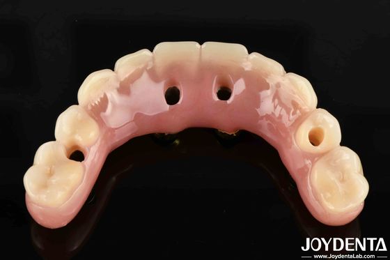 50ml Ti-Bar Acrylic Teeth Finish 24 Jam Waktu Penyembuhan Amerika Serikat Untuk Profesional Gigi