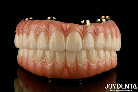 Natural Teeth And Gums Kompatibel Ti-Bar Zirconia Hybrid Bridge Dengan Biokompatibilitas Tinggi