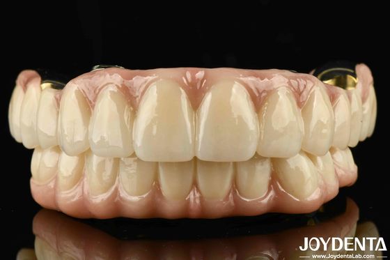 Kekuatan yang sangat baik Ti-Bar Zirconia Hybrid Bridge Untuk Kompatibilitas Gigi dan Gusi Alam