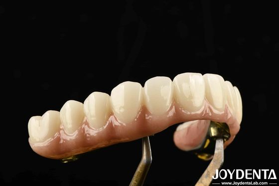 Jembatan hibrida Ti-Bar Zirconia yang tahan lama terbuat dari bahan titanium dan zirconia