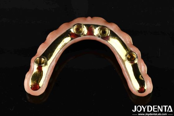 Nyaman Untuk Memakai Ti-Bar Memulihkan Fungsi Mengunyah Penting Ti-Bar Zirconia Hybrid Bridge Untuk Transaksi B2B