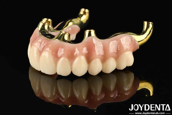 Memulihkan fungsi mengunyah Ti-Bar Zirconia Hybrid Bridge Dengan Biokompatibilitas Tinggi Dan Pas Tepat
