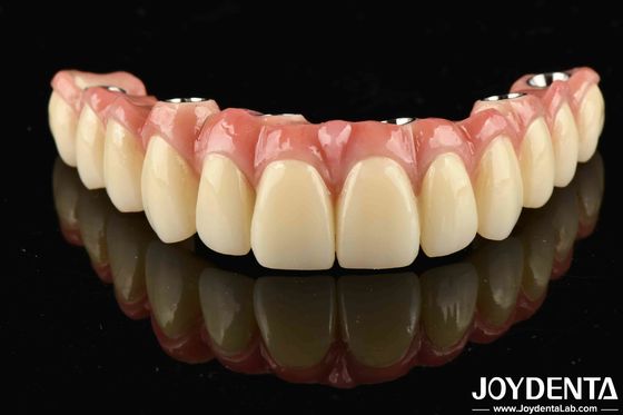 Low Density Light Weight Nyaman Untuk Memakai Titanium Malong Hybrid Bridge Untuk Kinerja Yang Lama