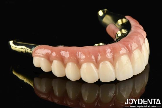 Katakan Selamat Tinggal Kepada Gigi Yang Hilang Dengan Zirconia
