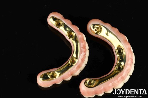 Jembatan Hibrida Zirconia dengan Daya Tahan Tinggi dan Biokompatibilitas