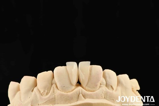 Ketahanan Tinggi Micro Veneer 0.2mm Ketebalan Dan Kinerja yang Dapat Diandalkan