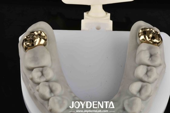 Rehabilitasi Lidah Dengan Dental Mencapai Senyum yang Lebih Cerah dan Sehat