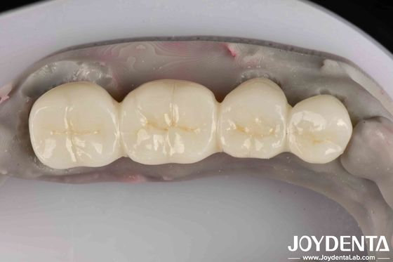 Produk putih yang sangat baik Zirconia penuh dengan ketahanan tinggi terhadap kemampuan korosi