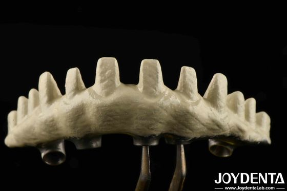 Jenis Sambungan Hex Internal Custom Abutments Implant Sandblasted Dan Asam-etched Untuk Fit Superior
