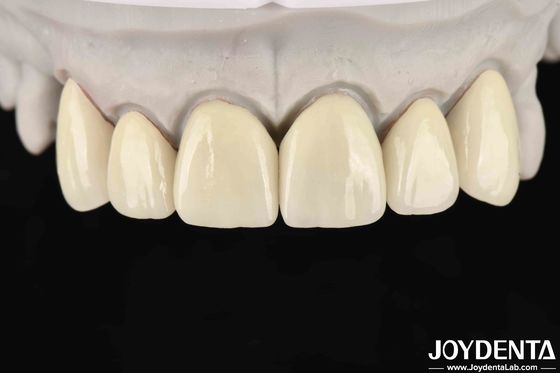 6.0-6.1 G/cm3 Density Layered Zirconia Untuk Translucence Tinggi Dalam CAD / CAM Milling