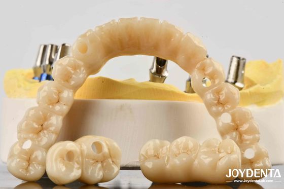 Keakuratan yang tak tertandingi Zirconia Implant Bridge Komitmen Untuk Kenyamanan