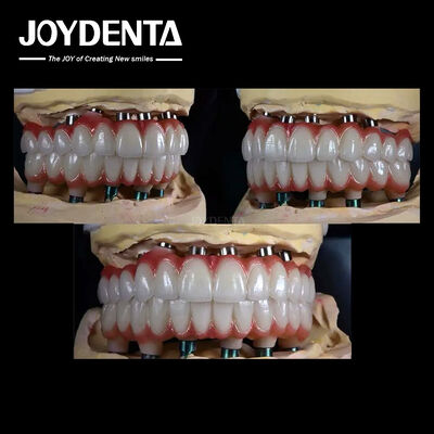 10mm Titanium Multiple Teeth Implant Permukaan kasar untuk restorasi gigi