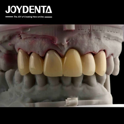 CAD CAM Processing Dental PMMA Material Multilayer Design Untuk Transisi Bayangan Alami