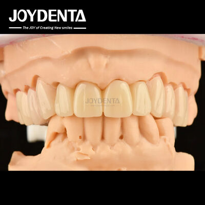 Multilayer PMMA Polymethyl Methacrylate Untuk Restorasi Gigi