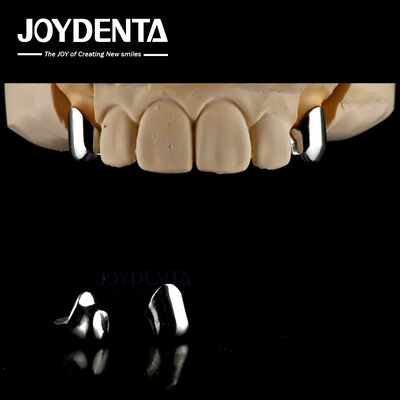 Prosthetic Removable Precision Dental Implant Attachments Mudah Bersih Nyaman Cocok