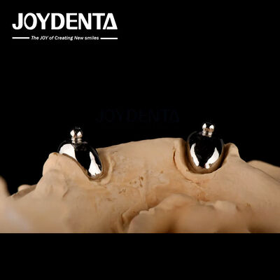 Joydental laboratorium gigi Ball Attachment