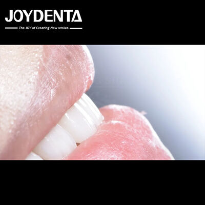 Panci Komposit Gigi yang Bertahan Lama Biokompatibilitas yang Baik Tidak Ada Drop Off veneer porselen