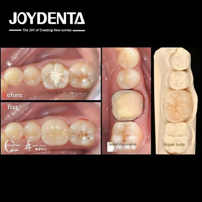 Biokompatibilitas dan Kompatibilitas Tinggi Dengan Restorasi Gigi Alami