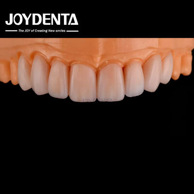 Kaca keramik veneer yang dapat disesuaikan terlihat alami ketahanan kimia yang tinggi