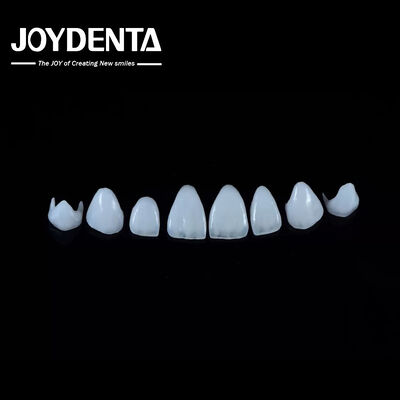 0.3-0.5mm tebal Porselen alami Emax veneers kekuatan tinggi tahan lama untuk estetika